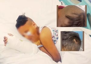 Μέγαρα: Στη φυλακή ο 23χρονος που ξυλοκόπησε άγρια τον 4χρονο