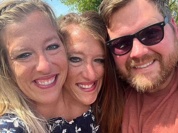 Είναι οι πιο διάσημες σιαμαίες στον κόσμο – Η μία παντρεύτηκε