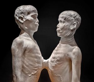 Τι γίνεται όταν ένας σιαμαίος διαπράττει έγκλημα αλλά ο αδερφός του είναι αθώος;