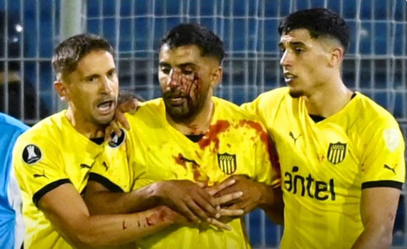 Σοκαριστικές εικόνες: Παίκτης της Πενιαρόλ δέχθηκε πέτρα στο πρόσωπο από οπαδούς της Ροζάριο Σεντράλ (vids)