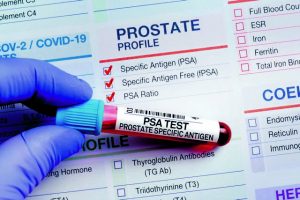 Γιατί το PSA μπαίνει ξανά στο μικροσκόπιο