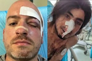 Ανθρωποκυνητό για τους νεαρούς που επιτέθηκαν στους εθελοντές – Οι στιγμές θρίλερ που έζησαν στην Πάρνηθα