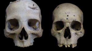 Καρκίνος: Απίθανη ανακάλυψη – Οι αρχαίοι Αιγύπτιοι προσπάθησαν να τον θεραπεύσουν