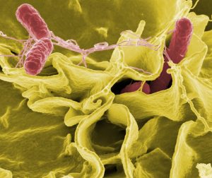 Φυματίωση και άλλα 5 ανθεκτικά μικρόβια μπαίνουν στην κρίσιμη λίστα του ΠΟΥ