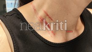 Ασύλληπτο περιστατικό βίας: Εβγαλε βόλτα τον σκύλο της και… την έδειραν