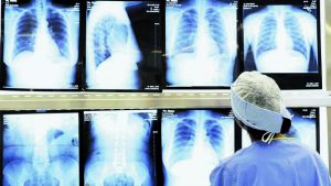 Παγκόσμια έξαρση ασθενειών στη μεταπανδημική εποχή