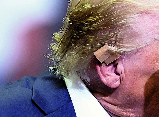 Τον πλήγωσε σφαίρα ή μήπως ήταν μόνο θραύσματα;