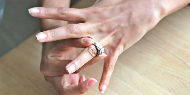 Χαλκιδική: Γιατροί έψαχναν βίντεο στο Youtube για να αφαιρέσουν δαχτυλίδι από χέρι ασθενούς και τελικά… φώναξαν ηλεκτρολόγο!