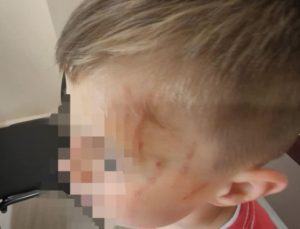 Αγρίνιο: Θύμα ξυλοδαρμού 5χρονος από συμμαθητές του στο νηπιαγωγείο