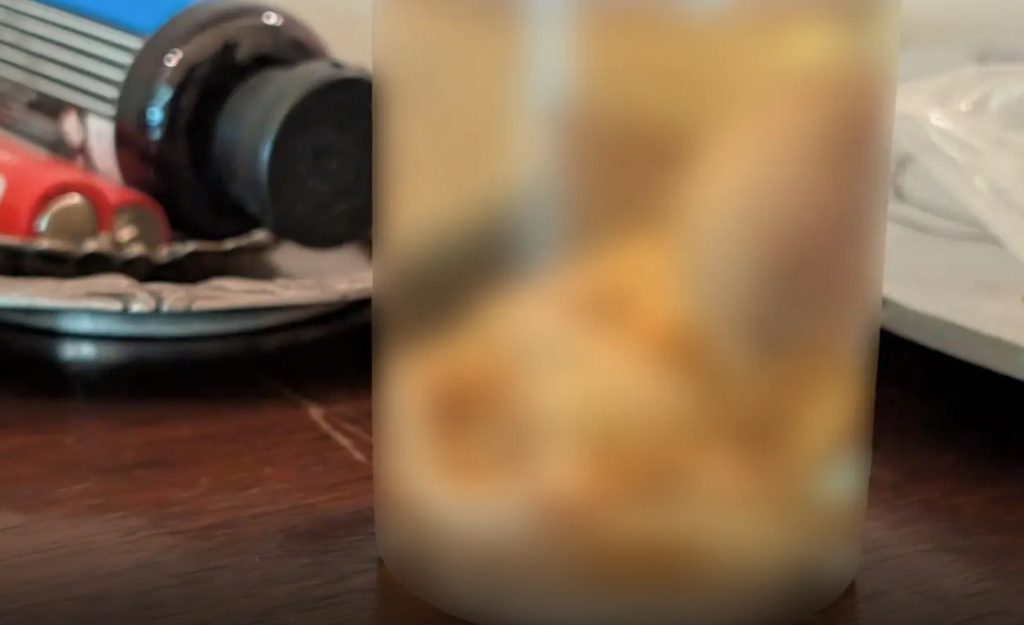 Φρίκη σε διαμέρισμα: Έμβρυο βρέθηκε μέσα σε γυάλινο μπουκάλι (εικόνες)