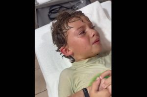 Γιατρός βγάζει ζωντανό καβούρι από το αυτί μικρού αγοριού στο Μεξικό (video)