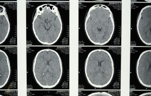 Αμφιβολίες για νέους «Φράνκενσταϊν»