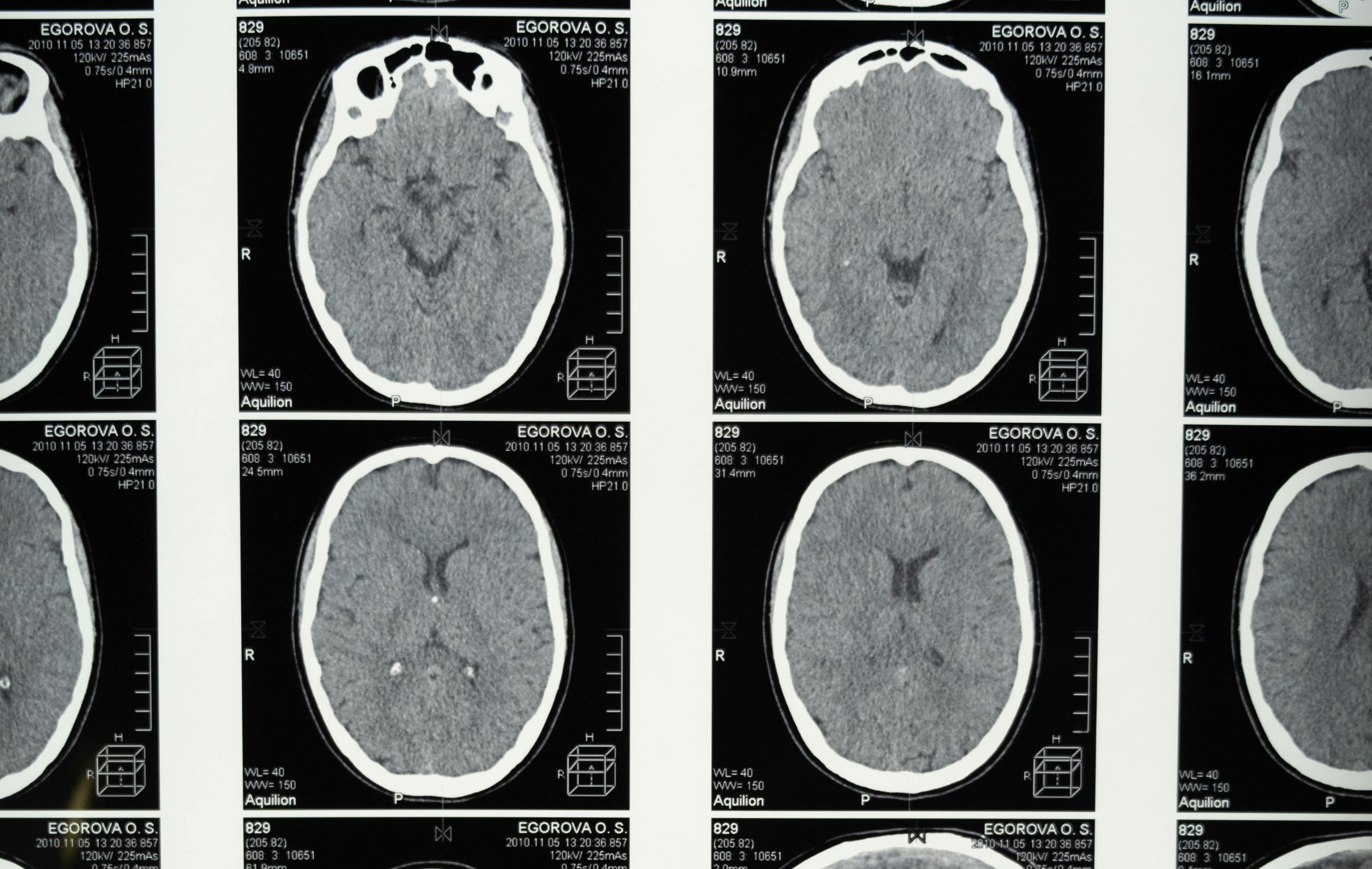 Αμφιβολίες για νέους «Φράνκενσταϊν»