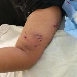 Πέραμα: Επίθεση σκύλου σε 12χρονο – «Το παιδί έχει σοβαρά τραύματα» δηλώνει στα «ΝΕΑ» η δικηγόρος της οικογένειας