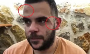 Γιάννενα: Ξυλοκόπησαν Youtuber σε live μετάδοση – «Δεν είναι η πρώτη φορά»