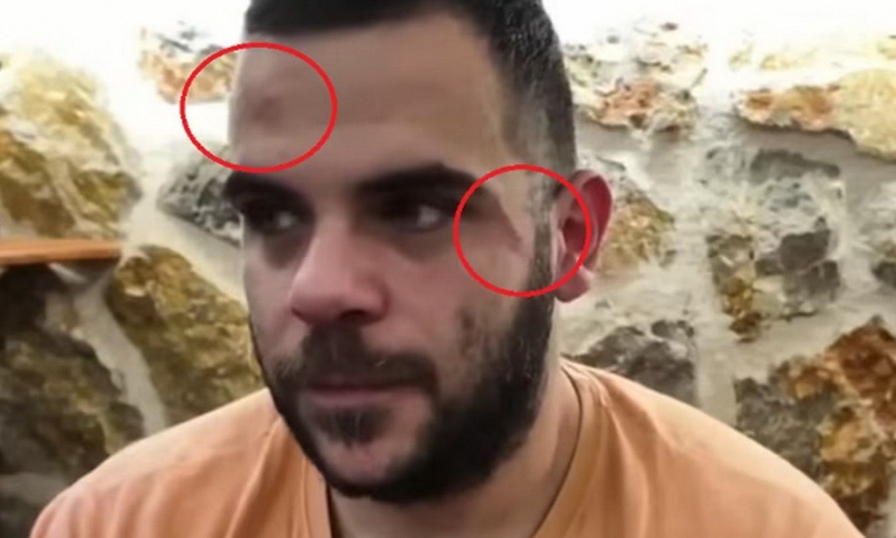 Γιάννενα: Ξυλοκόπησαν Youtuber σε live μετάδοση - «Δεν είναι η πρώτη φορά»