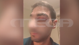 Σκηνές τρόμου στο νοσοκομείο Αιγαίου: Ασθενής ξυλοκοπούσε γιατρό επί 20 λεπτά – Τον έστειλε στο χειρουργείο