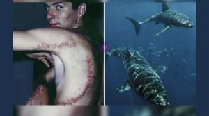 Σοκάρει θύμα καρχαρία: Μου επιτέθηκε ένας μεγάλος λευκός και μου άνοιξε την κοιλιά (video)