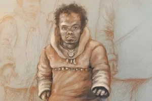 Κληρονομικές διαταραχές προϊστορικών ανθρώπων εντόπισαν ερευνητές