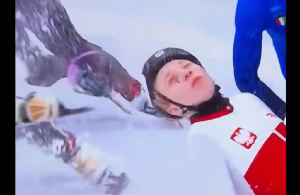 Χειμερινοί Ολυμπιακοί Αγώνες: Αθλήτρια τραυματίστηκε σοβαρά – παραλίγο να χάσει το μάτι της από λεπίδα αντιπάλου!