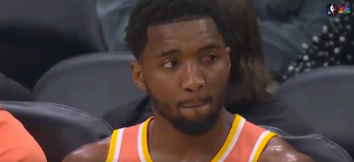 ΝBA: 42 πόντοι και ηγετική εμφάνιση με… ματωμένο μάτι από τον Μίτσελ