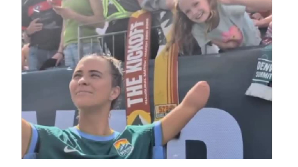 Μια στιγμή που ξεπερνά το ποδόσφαιρο: Η παίκτρια του Ντένβερ, Κάρσον Πίκετ συναντά μικρή φαν με την ίδια σπάνια ιδιαιτερότητα