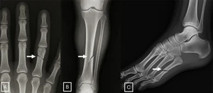 Κι όμως το κάνουν! Οι πλατφόρμες Τεχνητής Νοημοσύνης δημιουργούν ακτινογραφίες που ξεγελούν τους γιατρούς