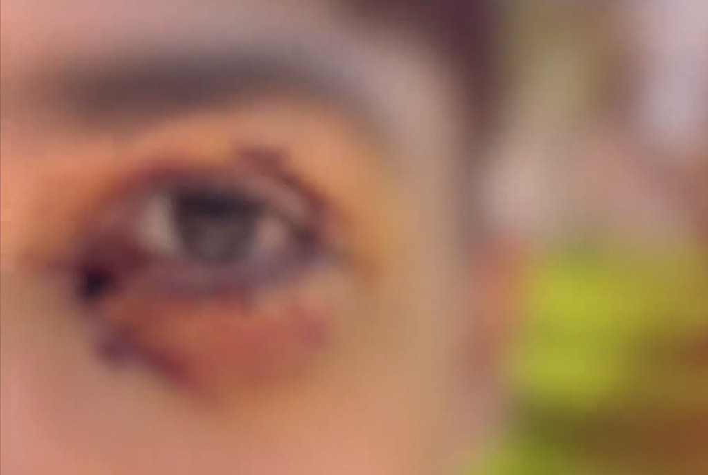 Σοκάρει η εικόνα του 16χρονου μετά την άγρια επίθεση από ομάδα ανηλίκων στα Ιωάννινα