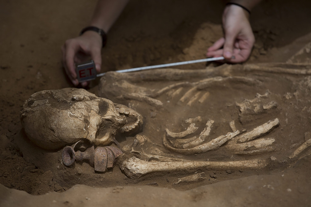 Σύφιλη πριν από την ιστορία: Ένας σκελετός 5.500 ετών αλλάζει όσα γνωρίζαμε για τις αρχαίες ασθένειες