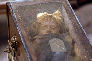 Ροζαλία Λομπάρντο: Το παιδί που μοιάζει να κοιμάται εδώ και 100 χρόνια – Πώς εξηγούνται τα «κινούμενα» βλέφαρά της