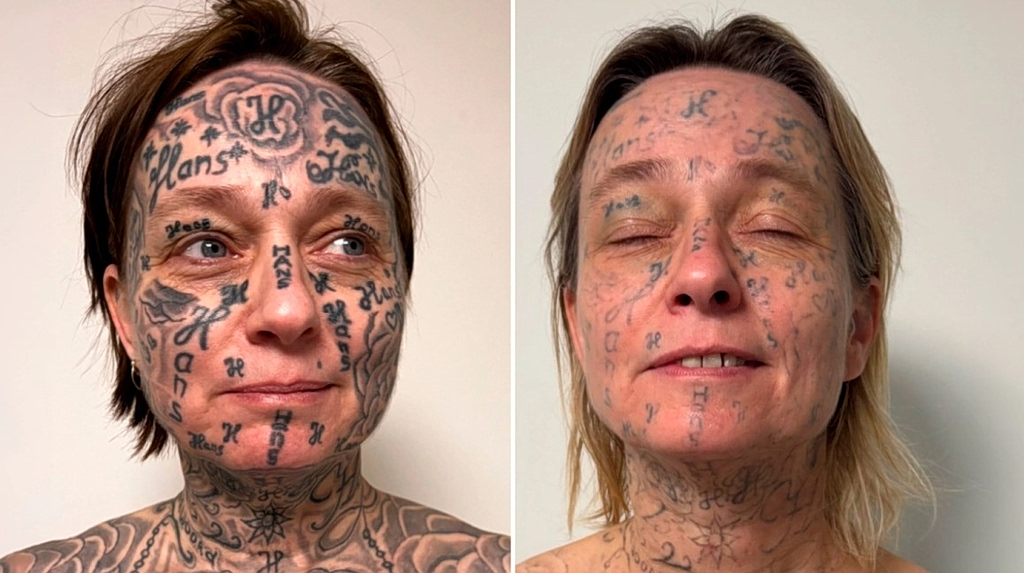 Κακοποίηση στην Ολλανδία: Έκανε τατουάζ το όνομά του στην κοπέλα του 250 φορές αφού την πότισε ναρκωτικά