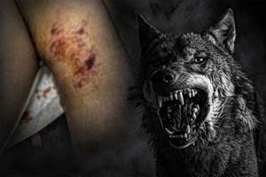 Κρήτη: Σκύλος επιτέθηκε σε 12χρονο στη Μεσαρά