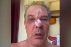 Χαϊδάρι: «Με πλάκωσε στο ξύλο, μου έσπασε το κόκκαλο στη μύτη» – Τι λέει ο άνδρας που έπεσε θύμα ξυλοδαρμού μέσα σε ιατρείο
